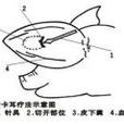 卡耳療法 卡耳療法