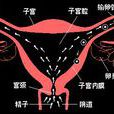 子宮輸卵管造影