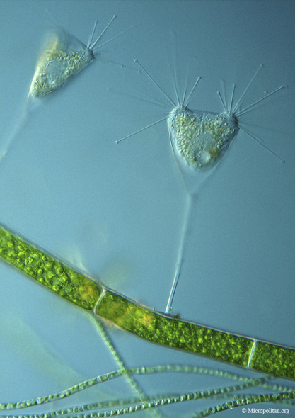 顯微鏡下的成年吸管蟲