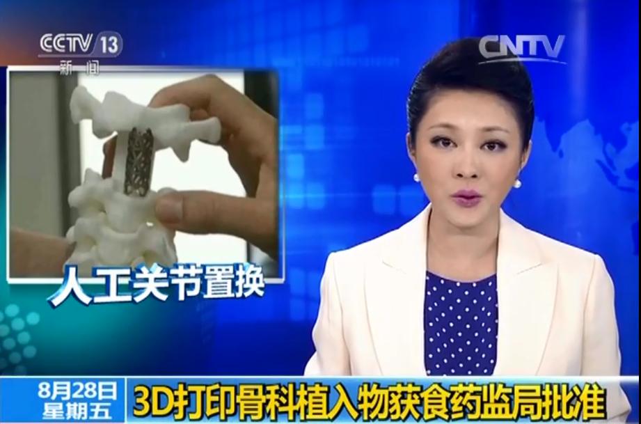 新聞報導上市的3D金屬列印人工髖關節產品