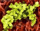 單核細胞增生李斯特菌