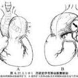 心內修復 心內修復
