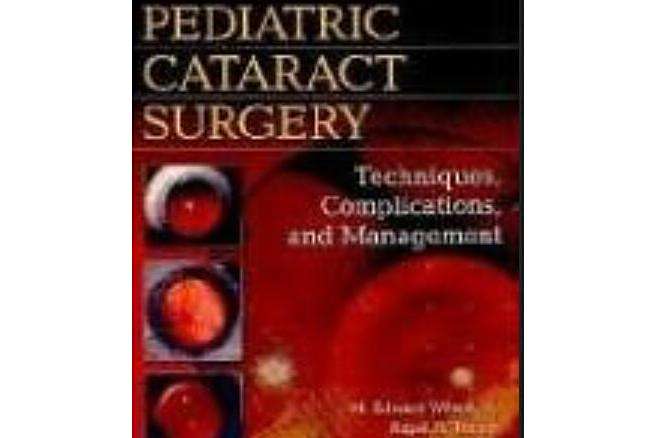 Pediatric Cataract Surgery Pediatric Cataract Surgery
