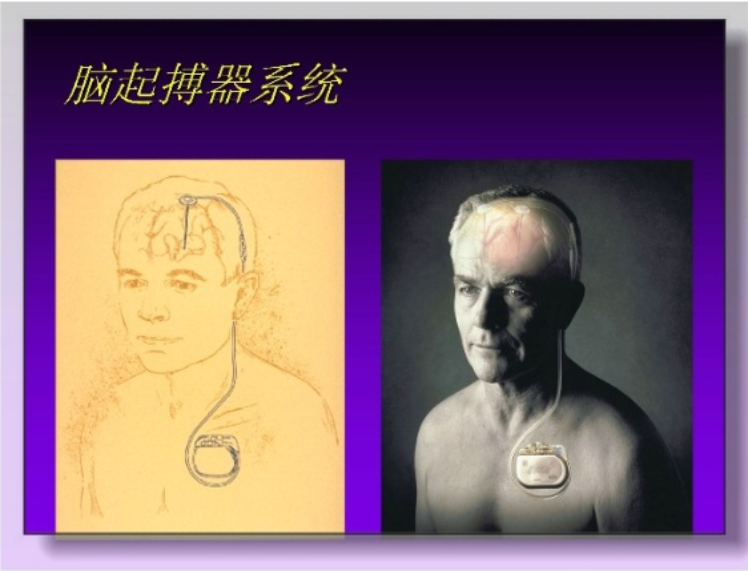 刺激控制 刺激控制