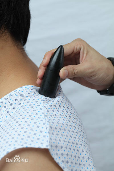 肩部砭石保健法