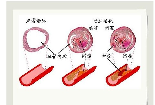 動脈(由心室發出的血管)