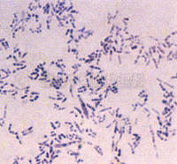 白喉棒狀桿菌的菌體