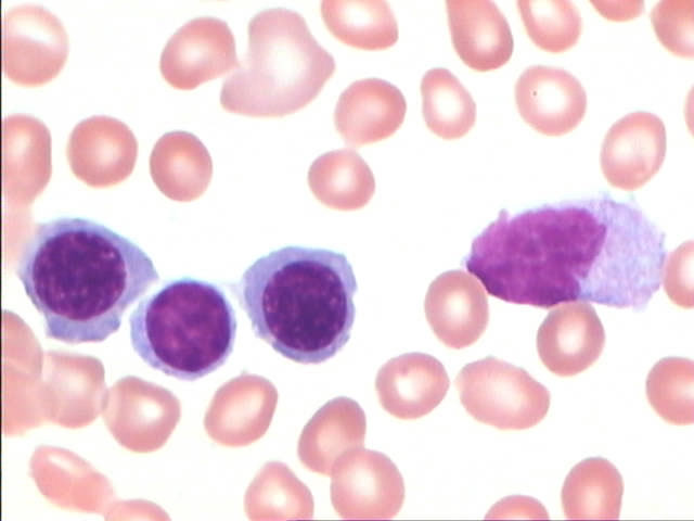 單核細胞(單核白血球)