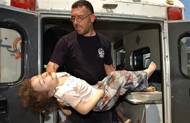 被炸傷的巴勒斯坦女童