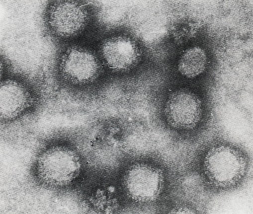 風疹病毒