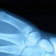 Xray Scanner Xray Scanner