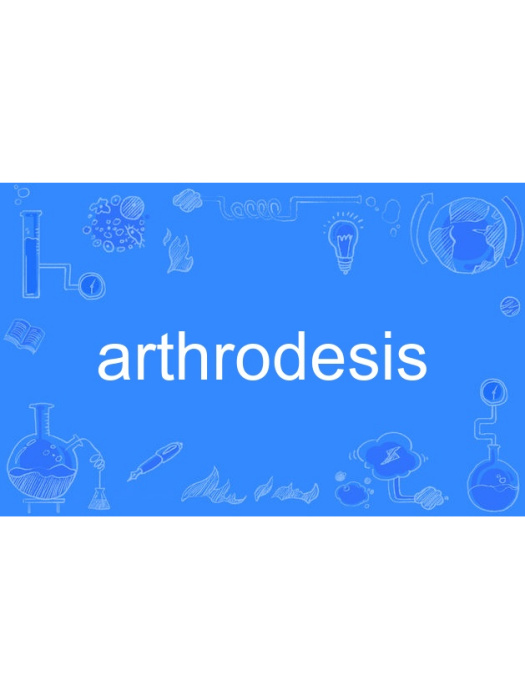 arthrodesis