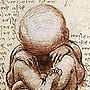 Fetal alcohol syndrome Fetal alcohol syndrome