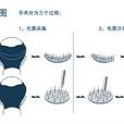 毛囊種植 毛囊種植