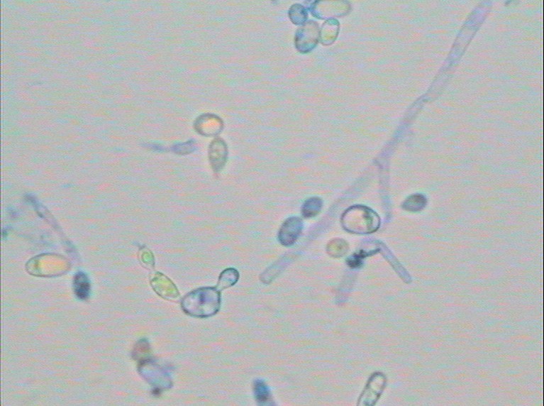 耳道假絲酵母菌
