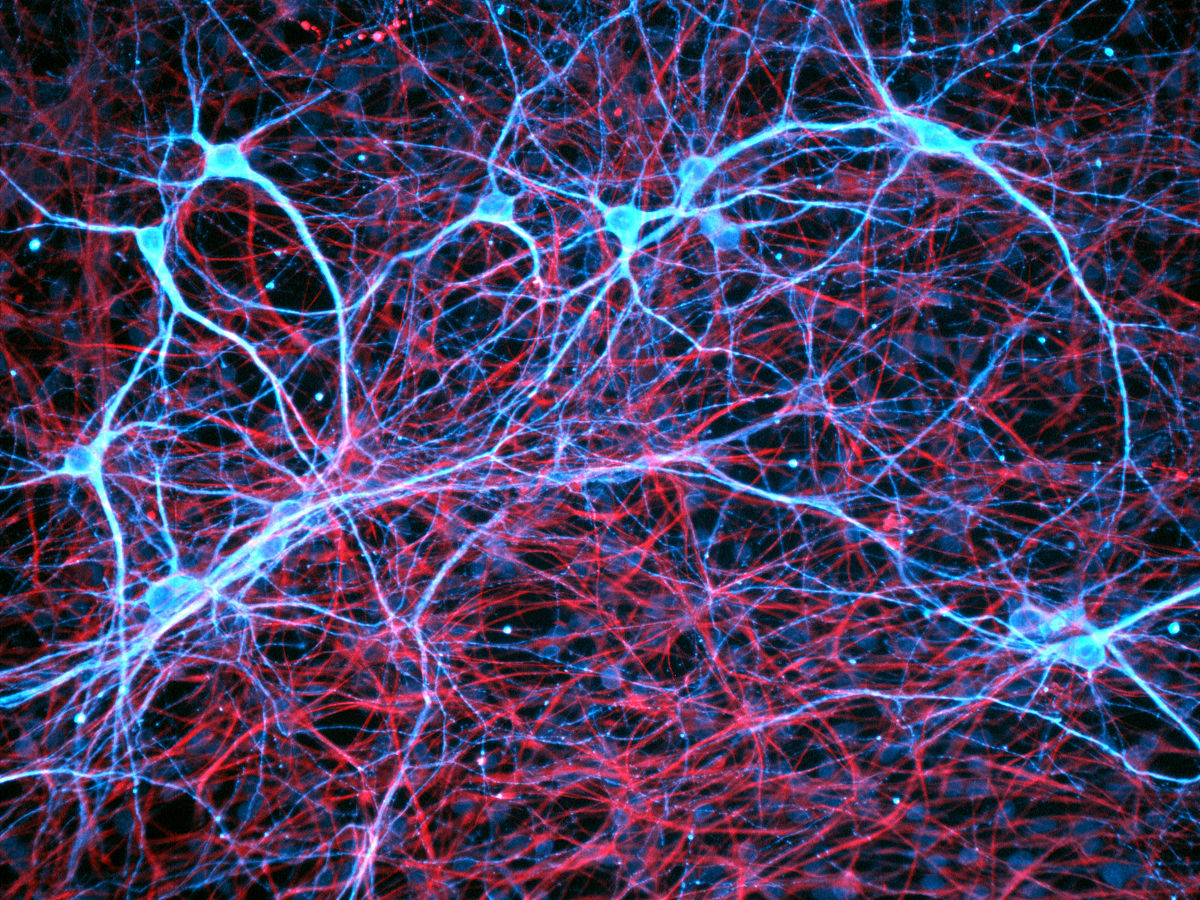 神經膠質細胞(膠質膜)