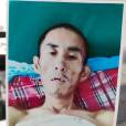 李四強(先天性智力缺陷者)
