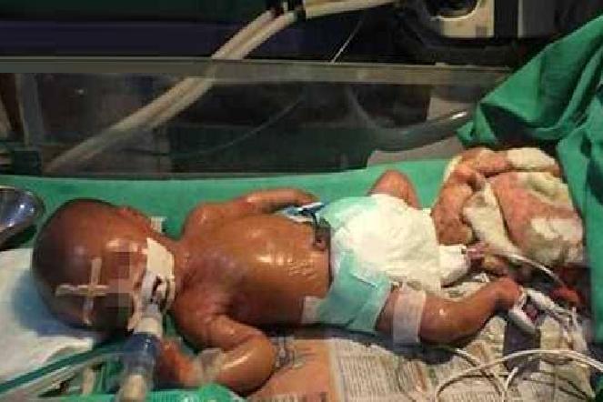 塑膠嬰兒 塑膠嬰兒