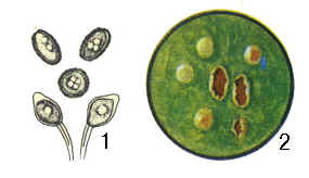 1夏孢子及冬孢子 2冬孢子堆（放大）