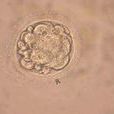 人類胚胎幹細胞