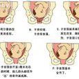 產程 產程