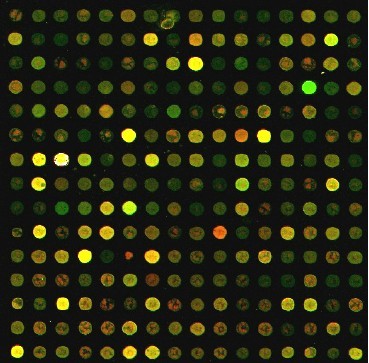 DNA 晶片螢光掃描分析圖