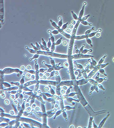 哈茨木黴菌，可寄生在高盧蜜環菌的菌索上
