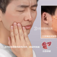 三叉神經痛(三叉神經疼)