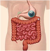 胃水球療法示意圖