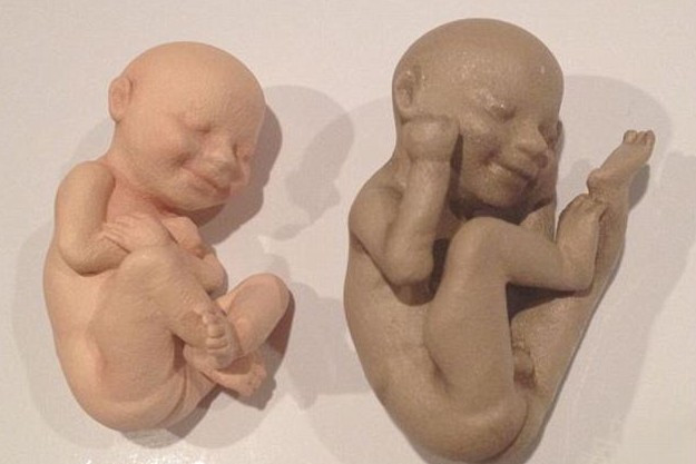 3D列印胎兒 3D列印胎兒