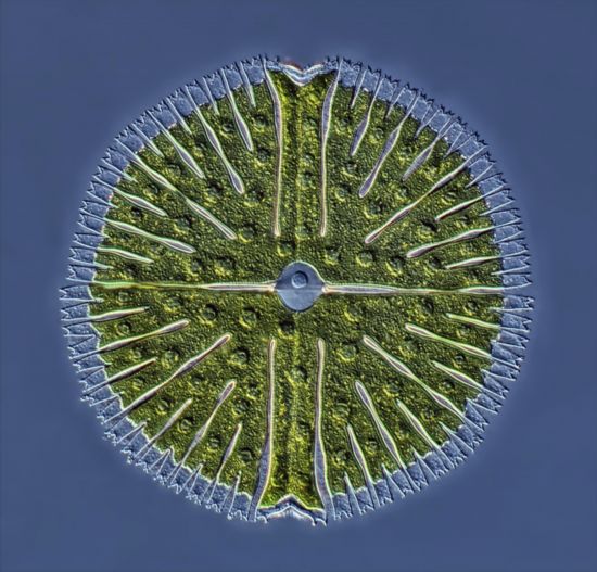 微分干涉顯微鏡下的輪蟲群