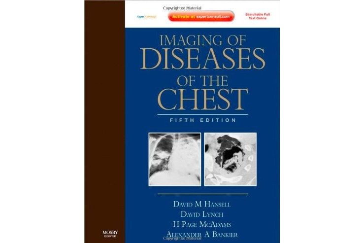 Imaging of Diseases of the Chest Imaging of Diseases of the Chest