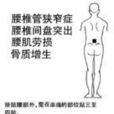 中醫外科膏藥