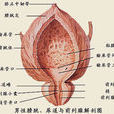 尿濁 尿濁