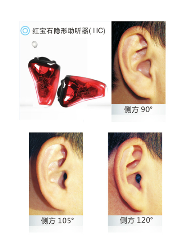 IIC隱形助聽器