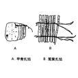 扎結訂 扎結訂