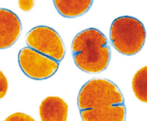 耐甲氧西林金黃色葡萄球菌