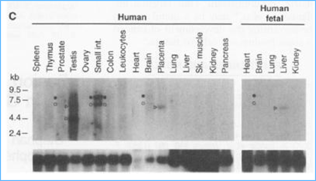 ALK的人體組織Northern（RNA）印跡分析