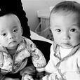 結石寶寶 結石寶寶