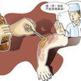塗搽法 塗搽法