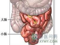 潰瘍性腸結核