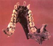 臘瑪古猿牙齒標本