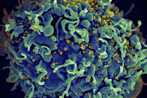 HIV-1基因段 HIV-1基因段