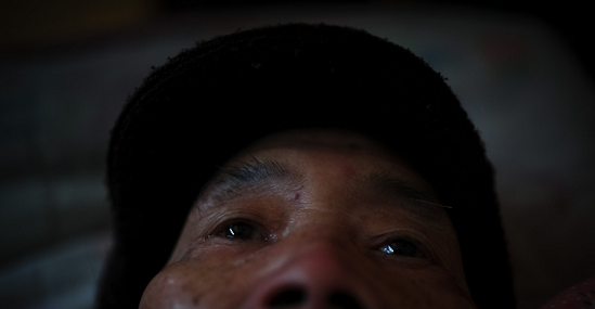 79歲的老村支書龔兆輝被診斷為砷中毒