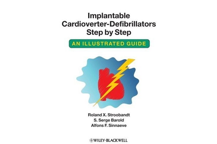 Implantable Cardioverter - Defibrillators Step by Step Implantable Cardioverter - Defibrillators Step by Step