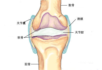 膝關節慢性滑膜炎圖片