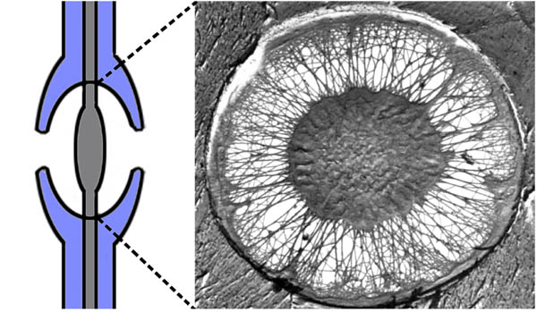 松柏類管胞的紋孔塞結構