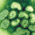 甲型H1N1流感科研進展摘要