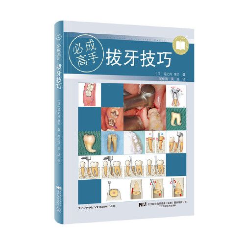 拔牙技巧 拔牙技巧