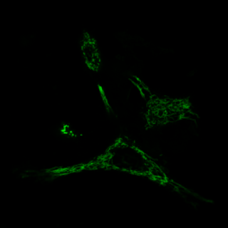 chromobody chromobody